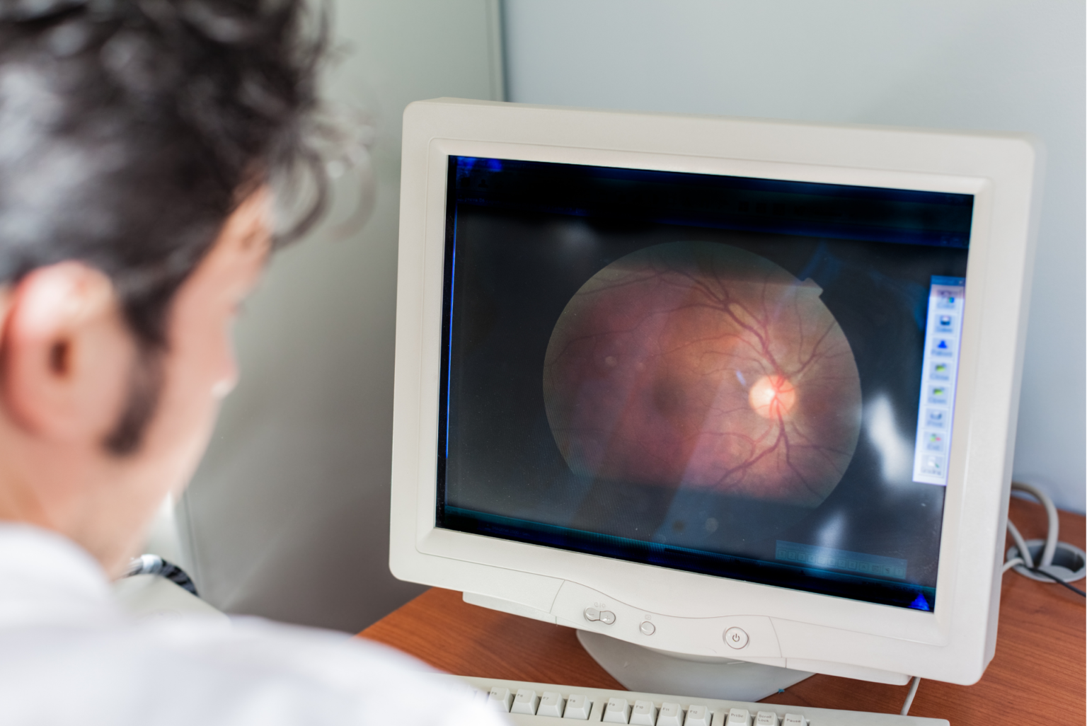 How the Optic Nerve Damage Causes Low Vision? Zoomax