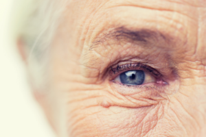 Aged-related ocular diseases