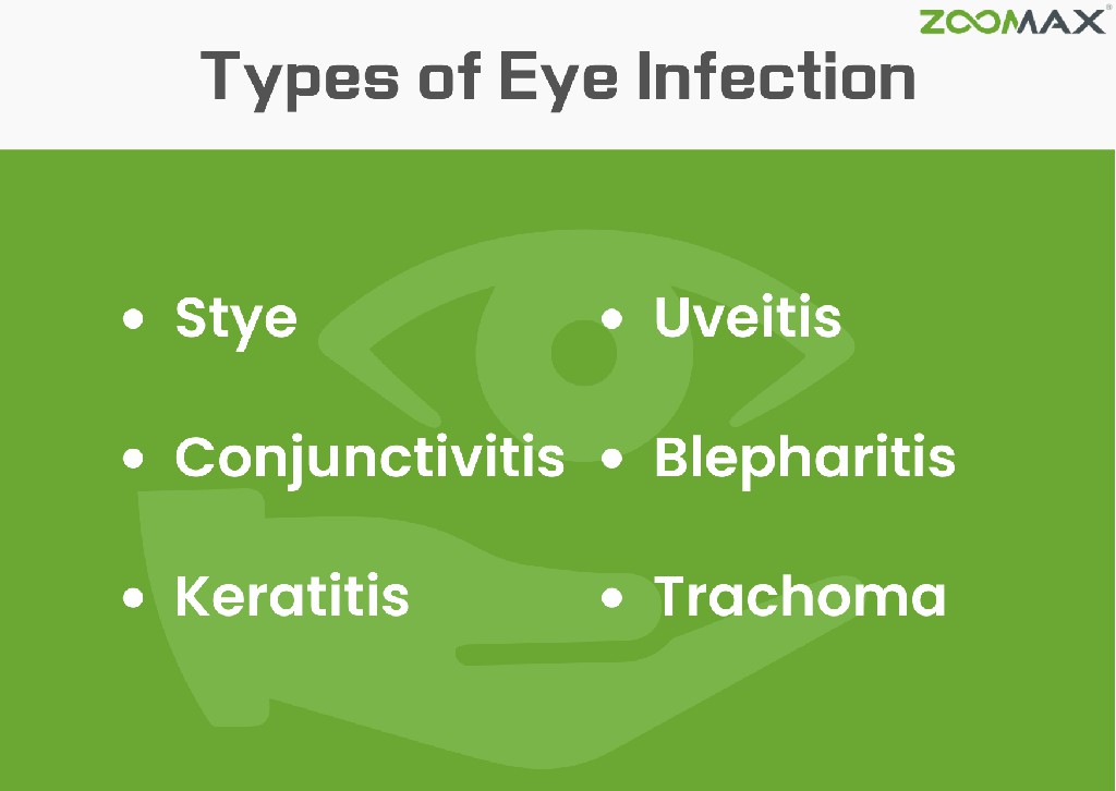 types of eye infection