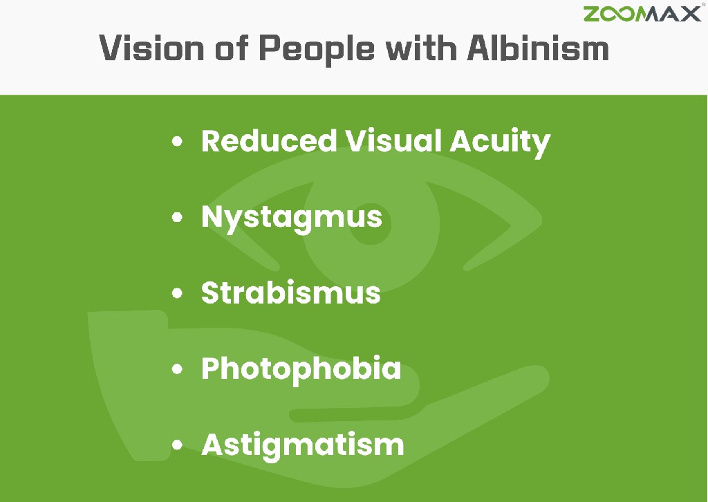 eye condition with albinism